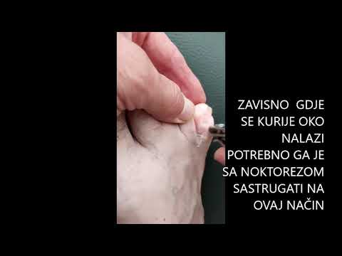 Kurije oko je jednostavno nestalo