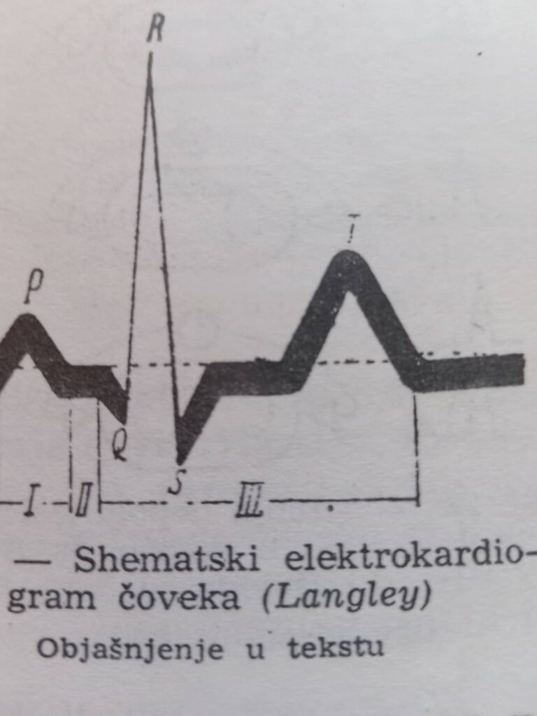 sematski elektrokardiogram coveka