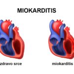 metabolicke odlike srcanog misica