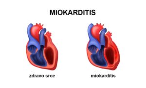 metabolicke odlike srcanog misica